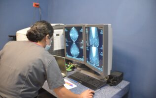 Realizan más de 29 mil pruebas para detectar tuberculosis en Guanajuato